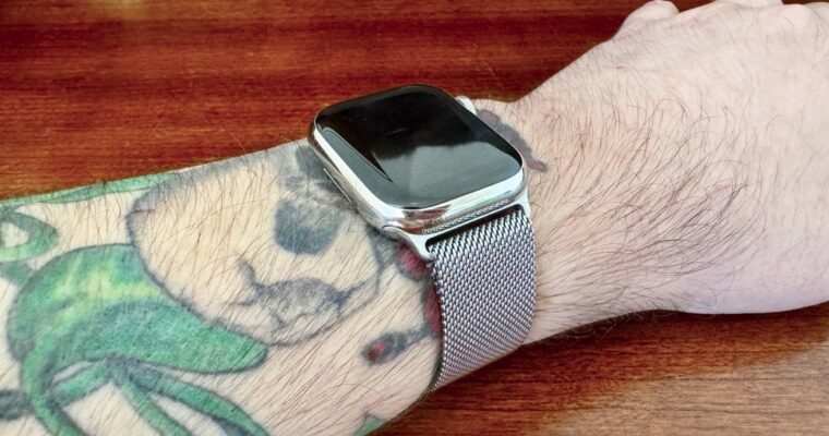 Problemas con el Apple Watch obligan a un usuario a someterse a la eliminación de tatuajes