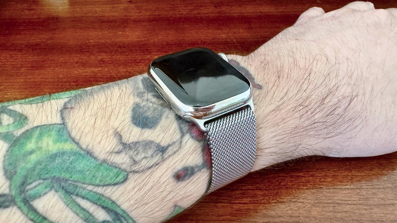 Problemas con el Apple Watch obligan a un usuario a someterse a la eliminación de tatuajes
